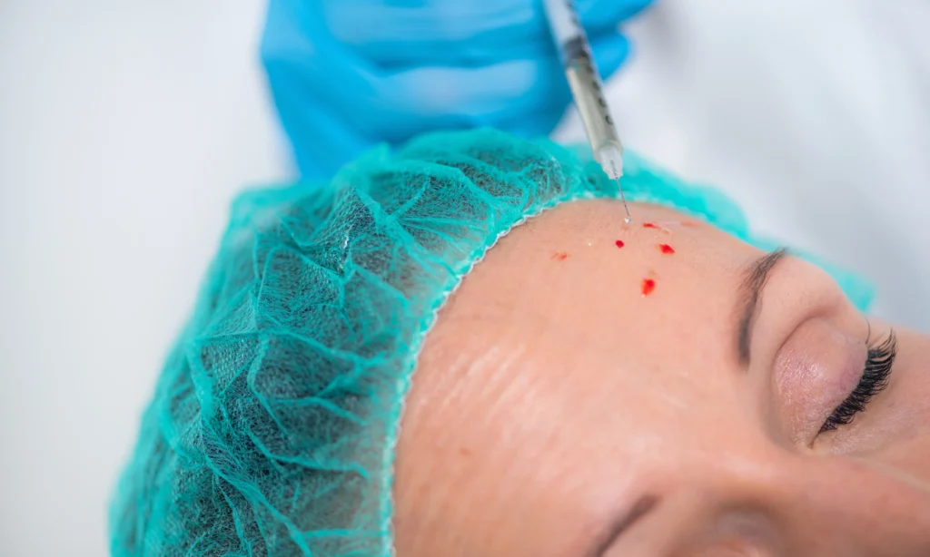 Polynucleotides in Lincoln: Is This the Skin Treatment You’ve Been Missing?