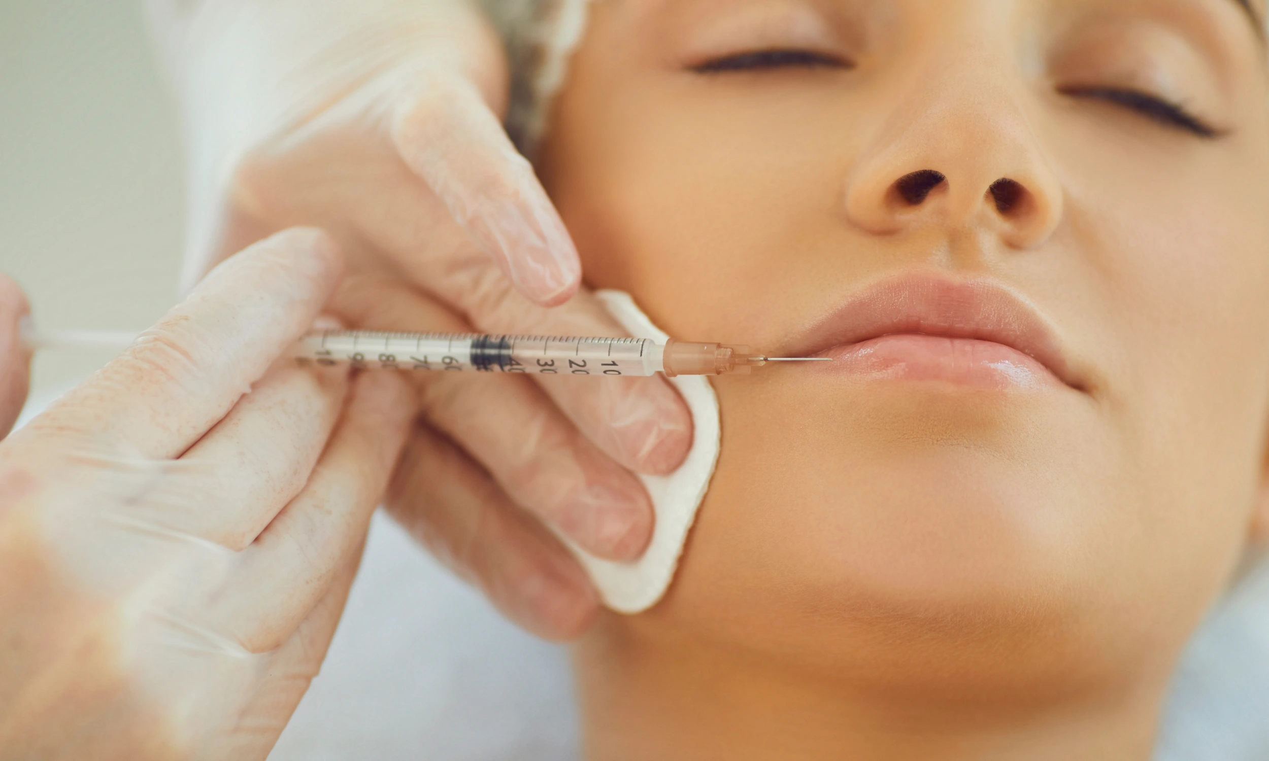 Lip Fillers in Lincoln: Natural Volume at Treeline Aesthetics